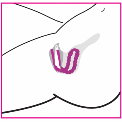 Petal Pusher - Siliconen Labia Spreader - Afbeelding 5